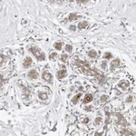 Atlas Antibodies Anti-ODF2L Antibody