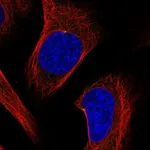 Atlas Antibodies Anti-ODF2 Antibody