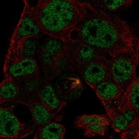Atlas Antibodies Anti-ODAM Antibody