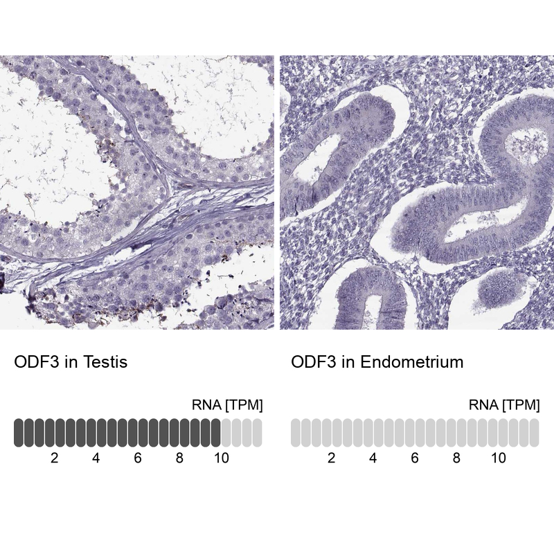 Atlas Antibodies Anti-ODF3 Antibody