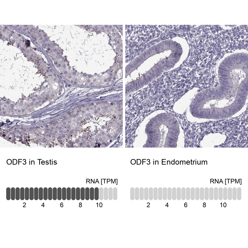 Atlas Antibodies Anti-ODF3 Antibody