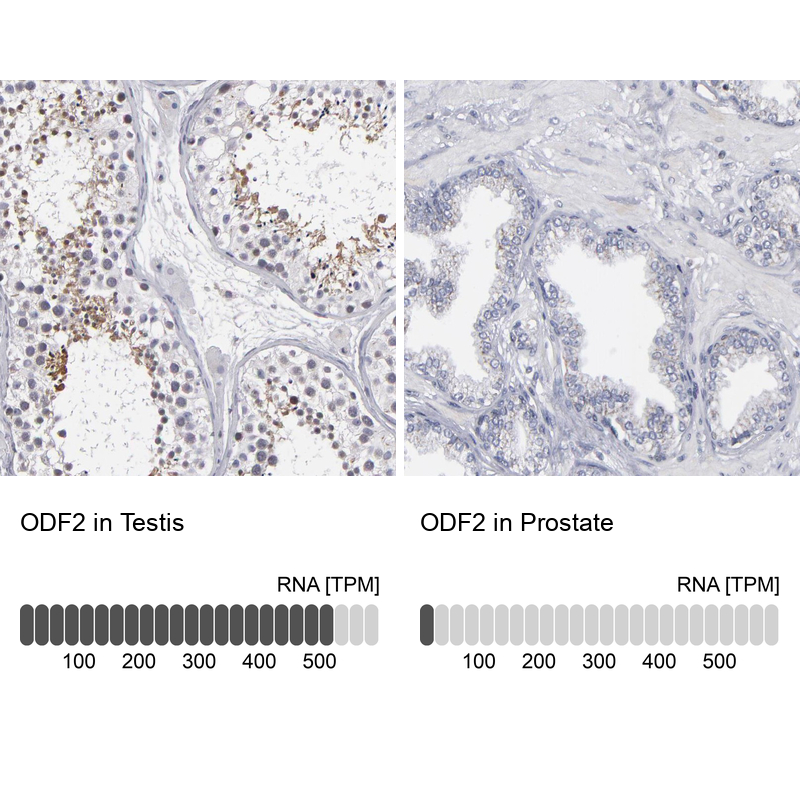 Atlas Antibodies Anti-ODF2 Antibody