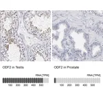 Atlas Antibodies Anti-ODF2 Antibody