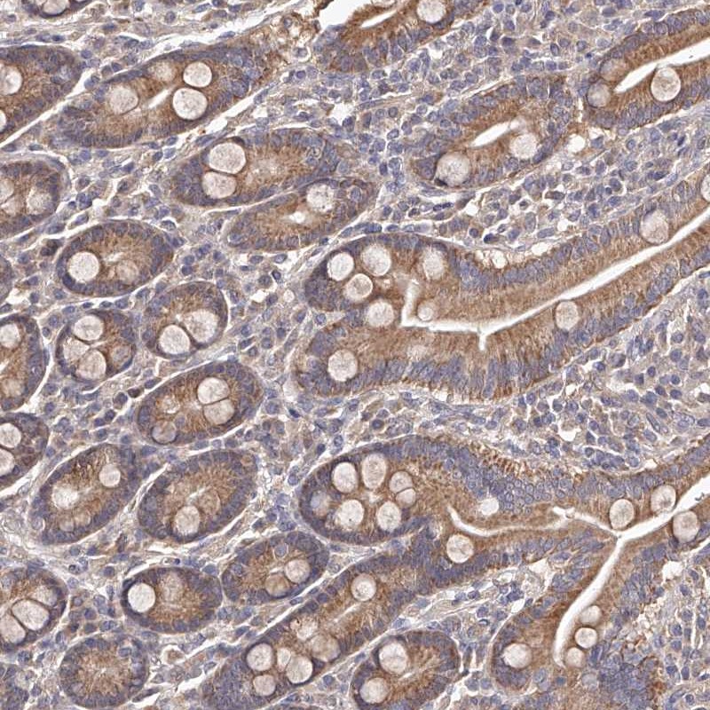 Atlas Antibodies Anti-ODF2L Antibody