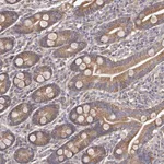 Atlas Antibodies Anti-ODF2L Antibody