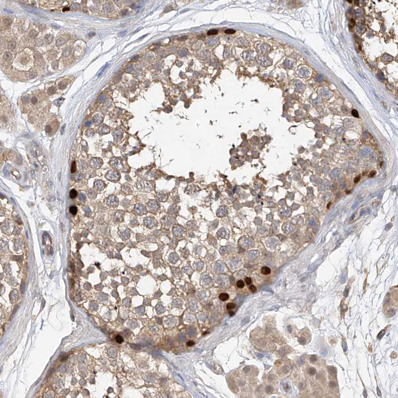 Atlas Antibodies Anti-OFD1 Antibody