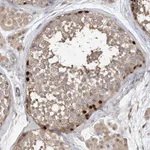 Atlas Antibodies Anti-OFD1 Antibody