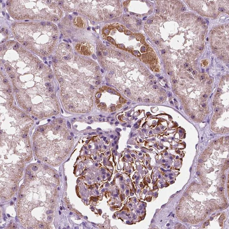 Atlas Antibodies Anti-ODF3L2 Antibody