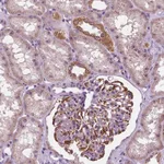 Atlas Antibodies Anti-ODF3L2 Antibody