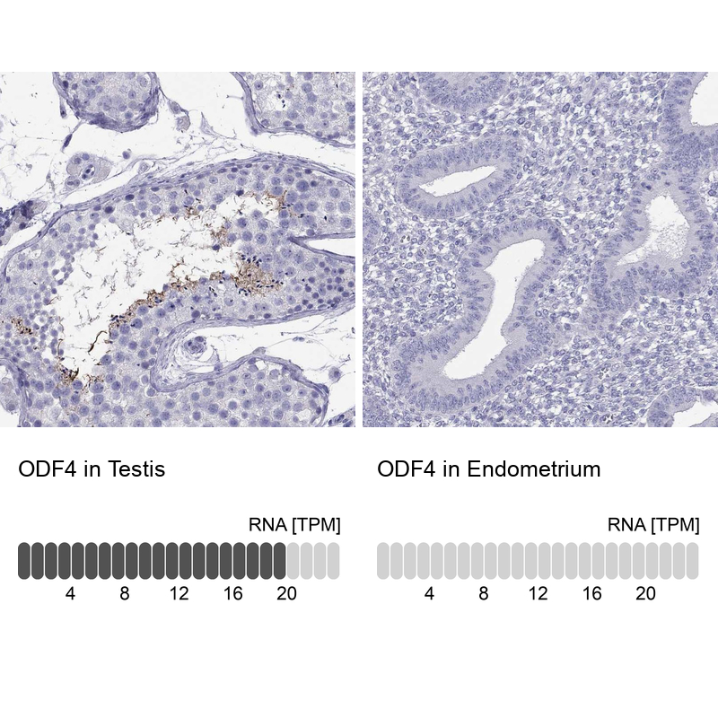 Atlas Antibodies Anti-ODF4 Antibody