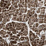 Atlas Antibodies Anti-OGDH Antibody