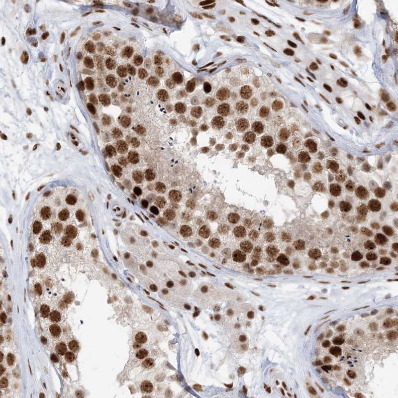 Atlas Antibodies Anti-OFCC1 Antibody