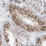 Atlas Antibodies Anti-OFCC1 Antibody