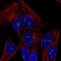 Atlas Antibodies Anti-OGDHL Antibody
