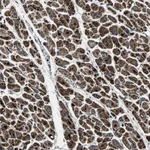 Atlas Antibodies Anti-OGDH Antibody