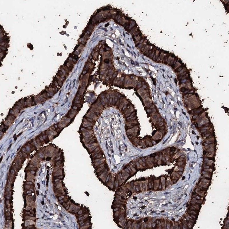 Atlas Antibodies Anti-OGFOD2 Antibody