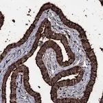 Atlas Antibodies Anti-OGFOD2 Antibody