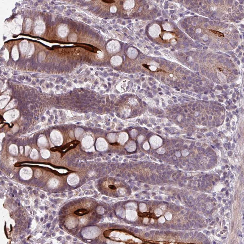 Atlas Antibodies Anti-OGFOD3 Antibody