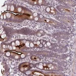Atlas Antibodies Anti-OGFOD3 Antibody