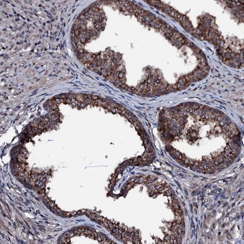 Atlas Antibodies Anti-OGFOD2 Antibody
