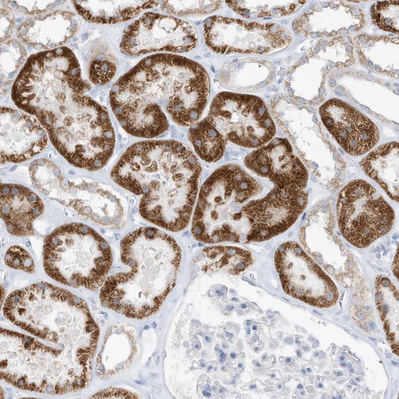 Atlas Antibodies Anti-OGT Antibody