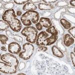 Atlas Antibodies Anti-OGT Antibody