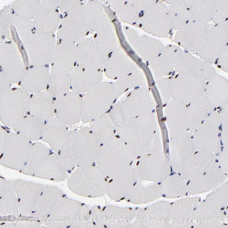 Atlas Antibodies Anti-OGFOD1 Antibody
