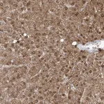 Atlas Antibodies Anti-OGT Antibody