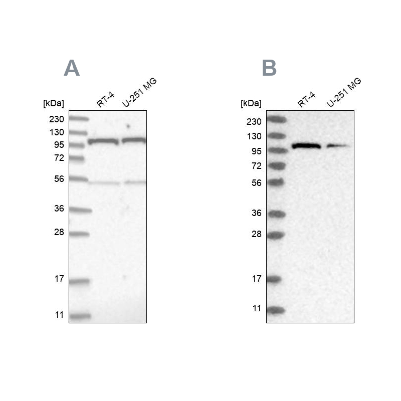 Atlas Antibodies Anti-OGT Antibody