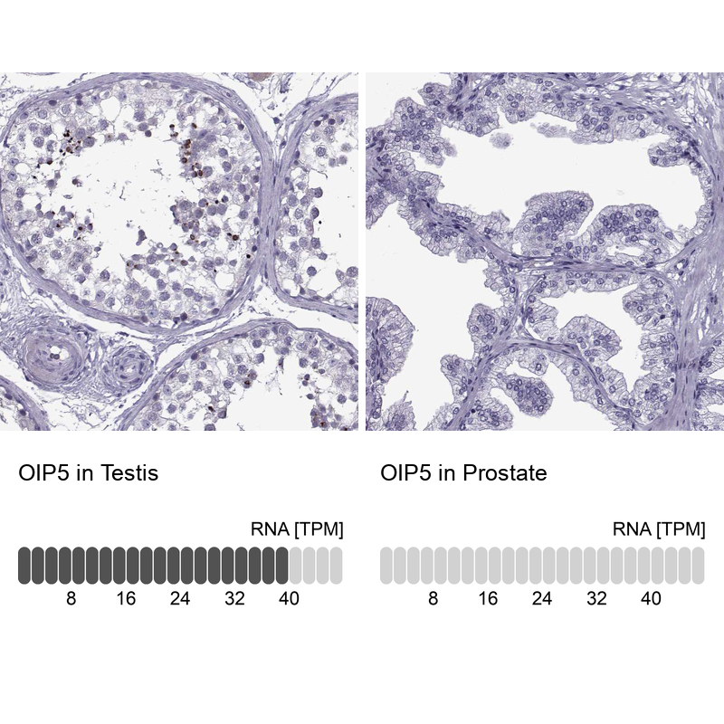 Atlas Antibodies Anti-OIP5 Antibody