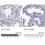 Atlas Antibodies Anti-OIP5 Antibody