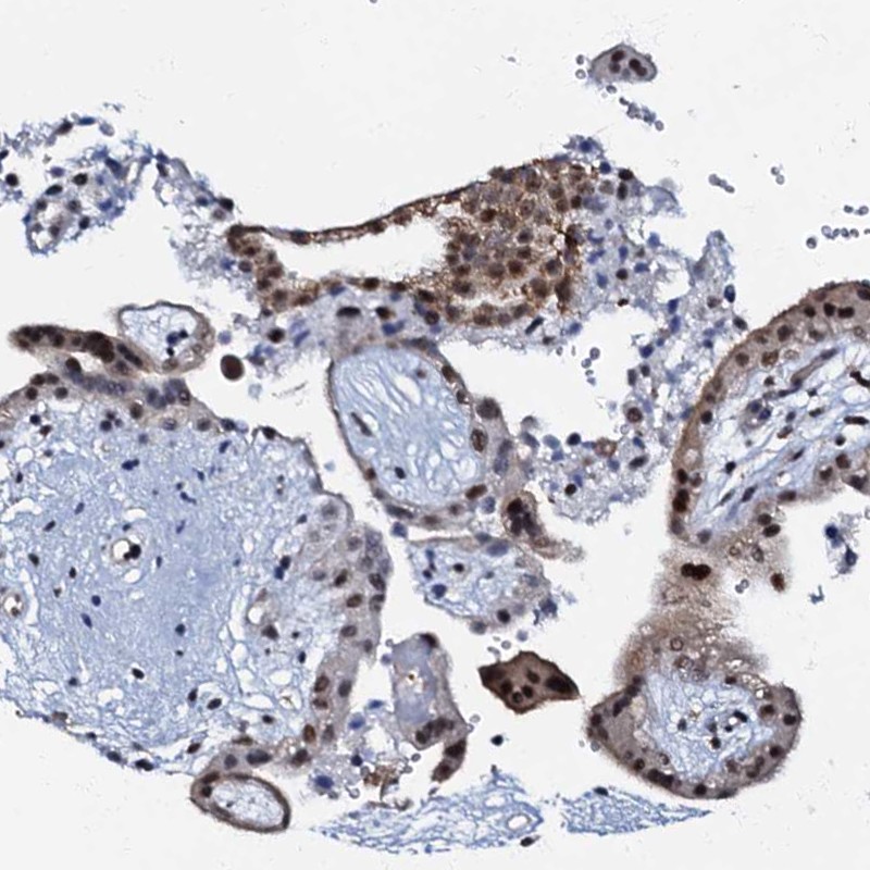 Atlas Antibodies Anti-OLAH Antibody