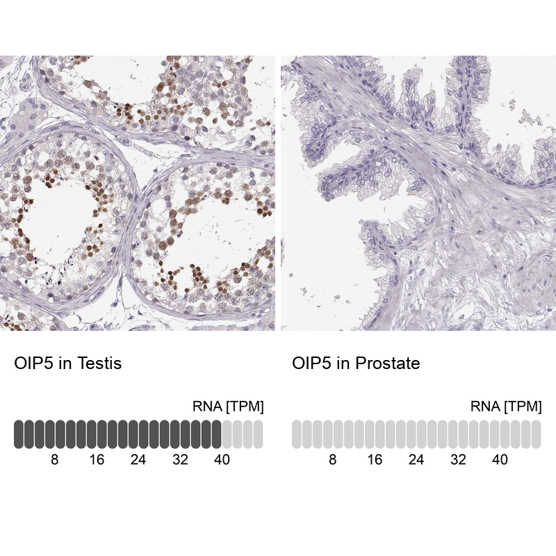 Atlas Antibodies Anti-OIP5 Antibody