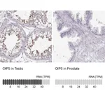Atlas Antibodies Anti-OIP5 Antibody