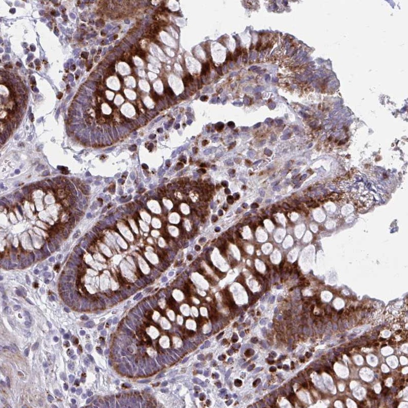 Atlas Antibodies Anti-OLFM2 Antibody