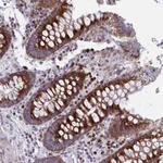 Atlas Antibodies Anti-OLFM2 Antibody