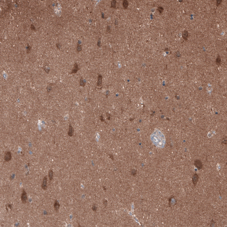 Atlas Antibodies Anti-OLA1 Antibody