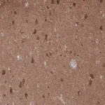 Atlas Antibodies Anti-OLA1 Antibody