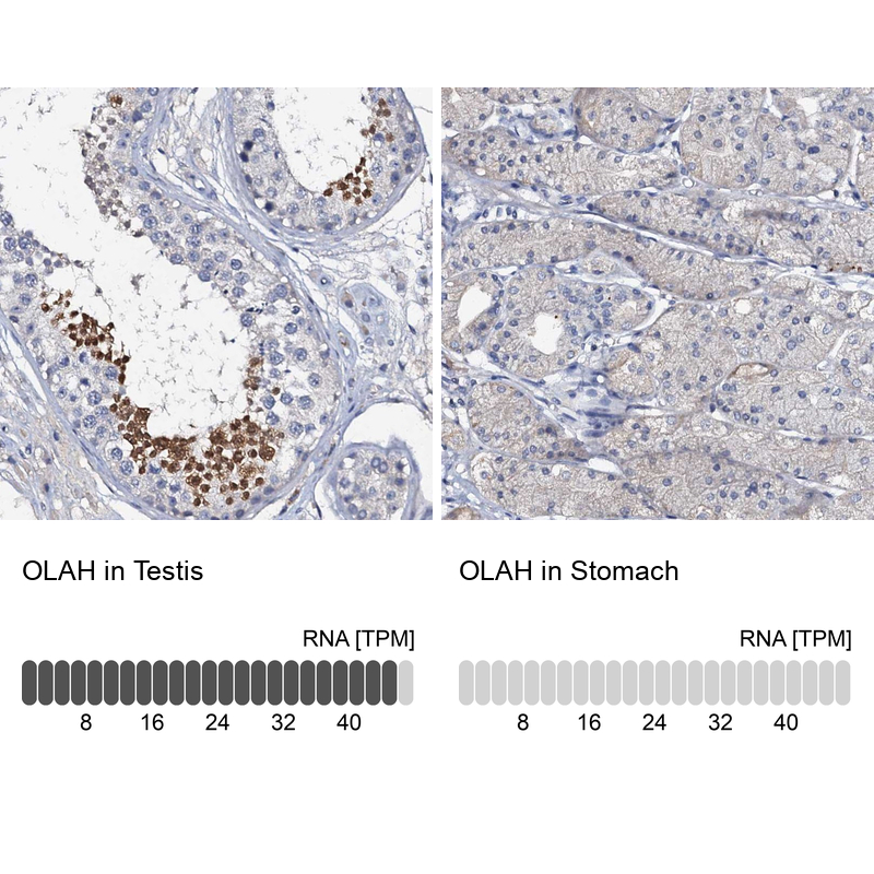 Atlas Antibodies Anti-OLAH Antibody
