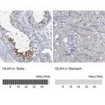 Atlas Antibodies Anti-OLAH Antibody