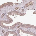 Atlas Antibodies Anti-OLFML2B Antibody