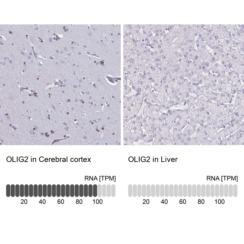 Atlas Antibodies Anti-OLIG2 Antibody