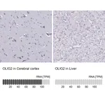 Atlas Antibodies Anti-OLIG2 Antibody