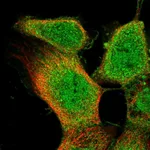 Atlas Antibodies Anti-OLR1 Antibody