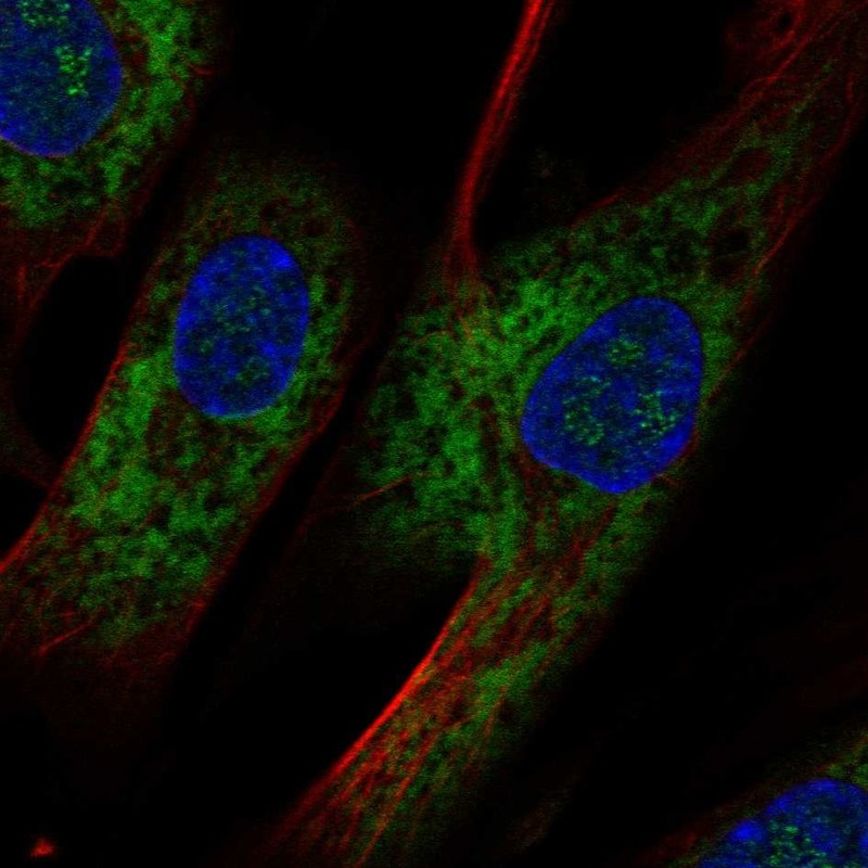 Atlas Antibodies Anti-OMD Antibody