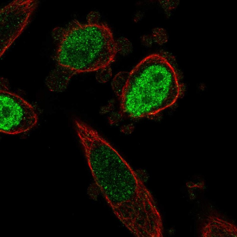 Atlas Antibodies Anti-ONECUT3 Antibody