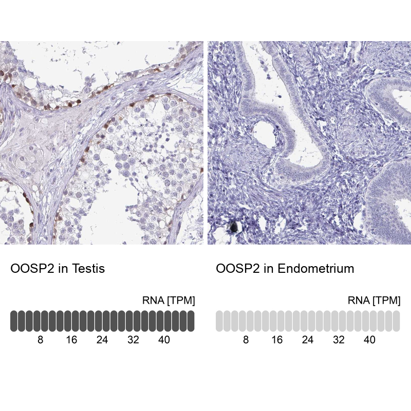 Atlas Antibodies Anti-OOSP2 Antibody