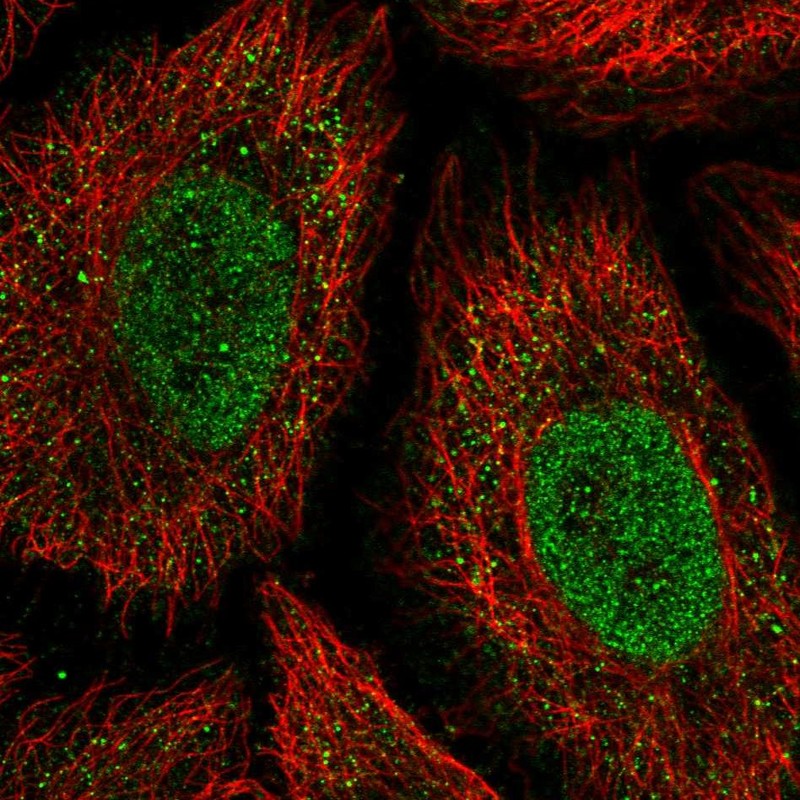 Atlas Antibodies Anti-ONECUT2 Antibody