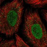 Atlas Antibodies Anti-ONECUT2 Antibody