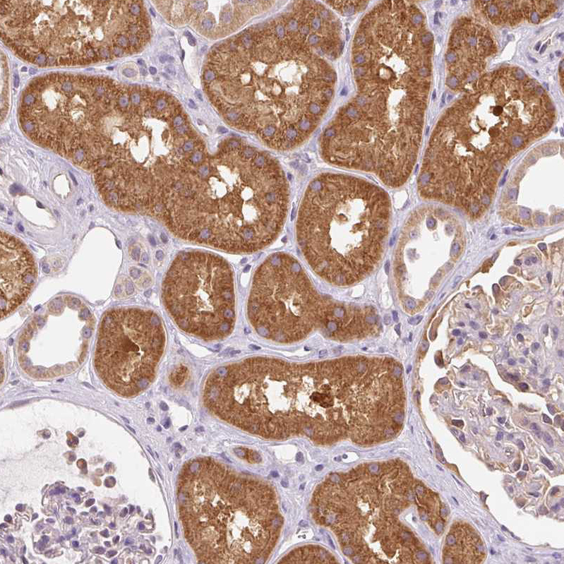 Atlas Antibodies Anti-OMA1 Antibody